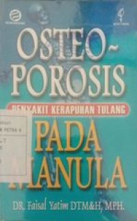 Osteoporosis penyakit kerapuhan tulang pada manula